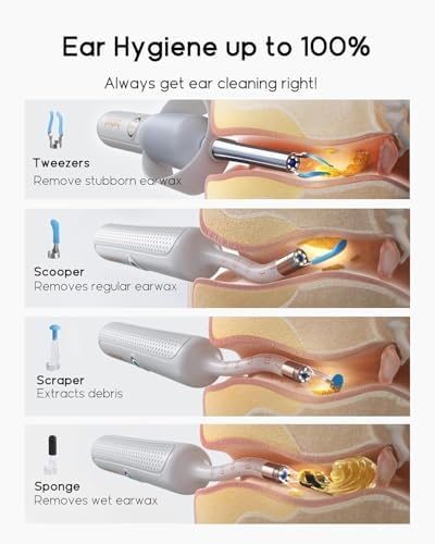 Bebird R37R Ear Wax Removal Tool Camera, Flexible Scope and Visual Tweezers