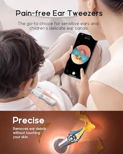 Bebird R37R Ear Wax Removal Tool Camera, Flexible Scope and Visual Tweezers