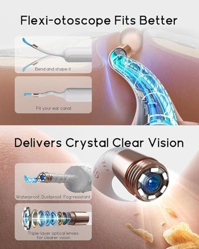 Bebird R37R Ear Wax Removal Tool Camera, Flexible Scope and Visual Tweezers