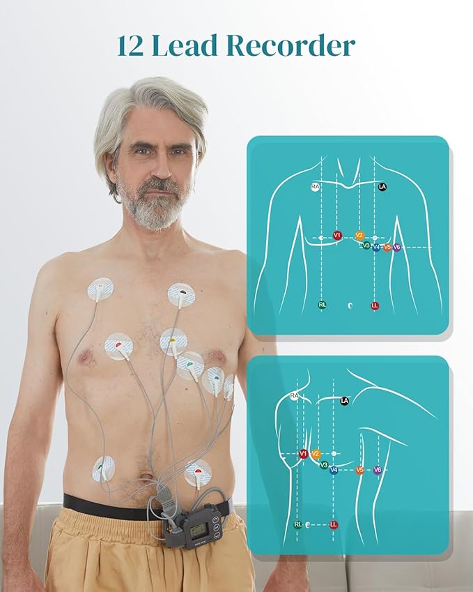 Portable 12-Lead Heart Monitor with AI Analysis for Home Use, 24 Hours Recording, Stand-Alone Machine with LCD Screen, Software Compatible with Mac & Windows, TH12