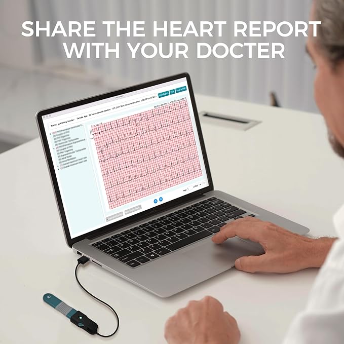 1-Lead Heart Health Monitor at Home, Portable 24 Hours Chest Lead Device with Free AI Analysis & PC Report, Rechargeable Recorder, HHM1
