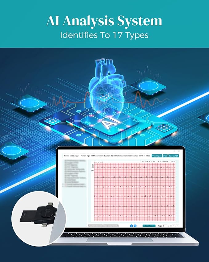 Portable 12-Lead Heart Monitor with AI Analysis for Home Use, 24 Hours Recording, Stand-Alone Machine with LCD Screen, Software Compatible with Mac & Windows, TH12