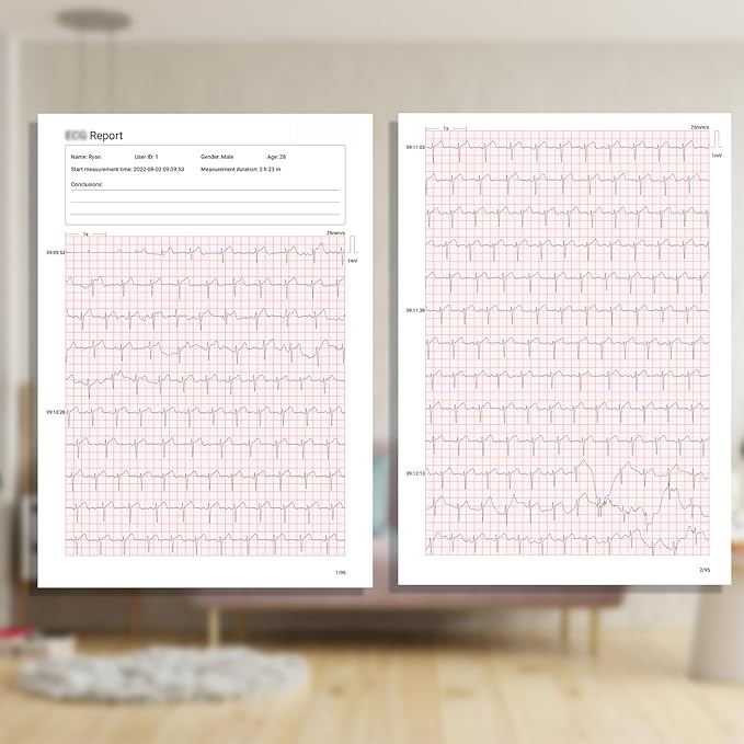 1-Lead Heart Health Monitor at Home, Portable 24 Hours Chest Lead Device with Free AI Analysis & PC Report, Rechargeable Recorder, HHM1