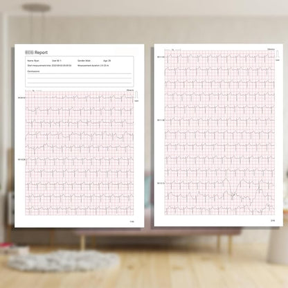 1-Lead Heart Health Monitor at Home, Portable 24 Hours Chest Lead Device with Free AI Analysis & PC Report, Rechargeable Recorder, HHM1