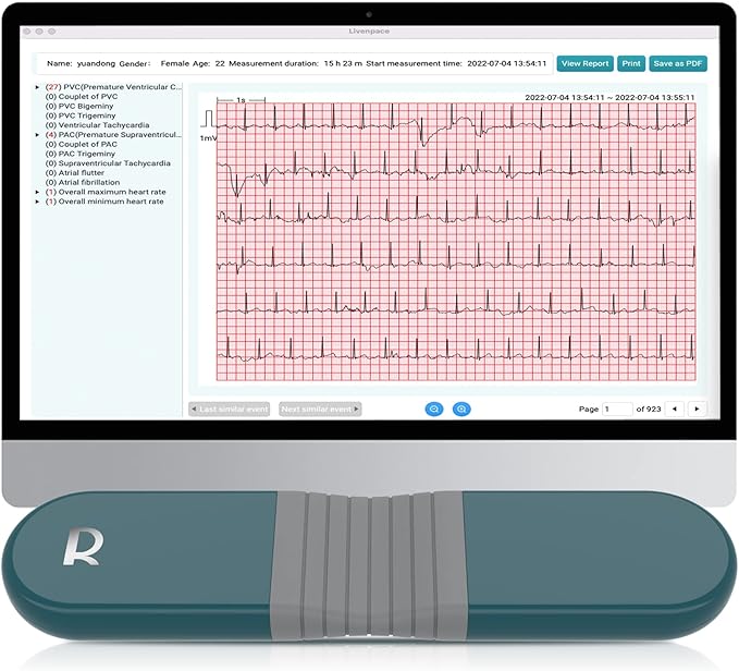 1-Lead Heart Health Monitor at Home, Portable 24 Hours Chest Lead Device with Free AI Analysis & PC Report, Rechargeable Recorder, HHM1