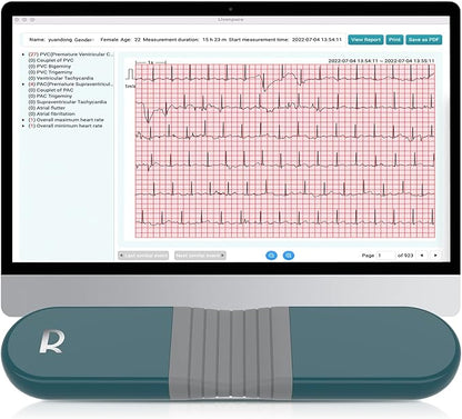 1-Lead Heart Health Monitor at Home, Portable 24 Hours Chest Lead Device with Free AI Analysis & PC Report, Rechargeable Recorder, HHM1